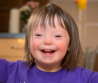 people with translocation down syndrome