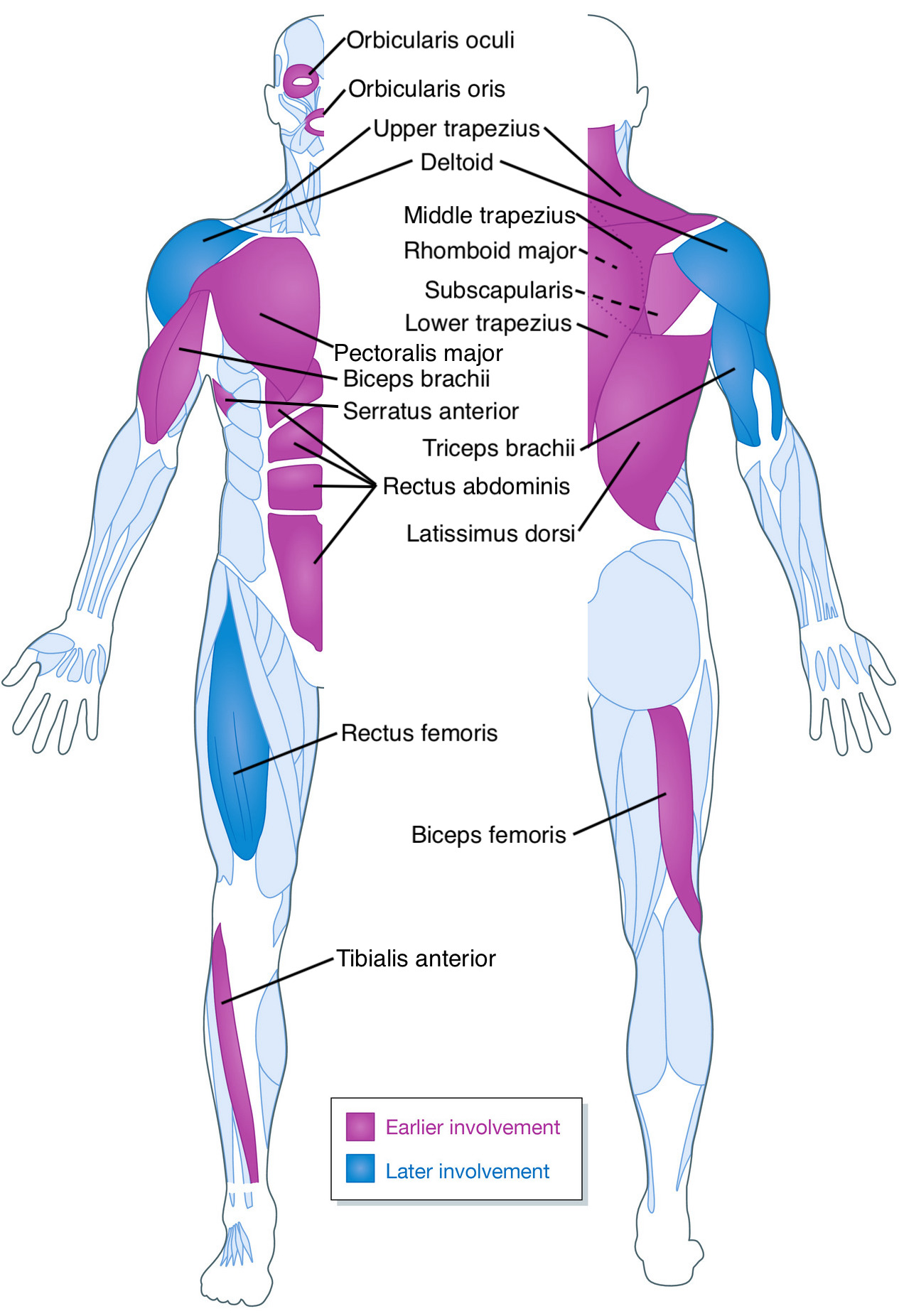 Muscular Dystrophy - Child Neurology Center